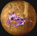 Mercury in Cancer